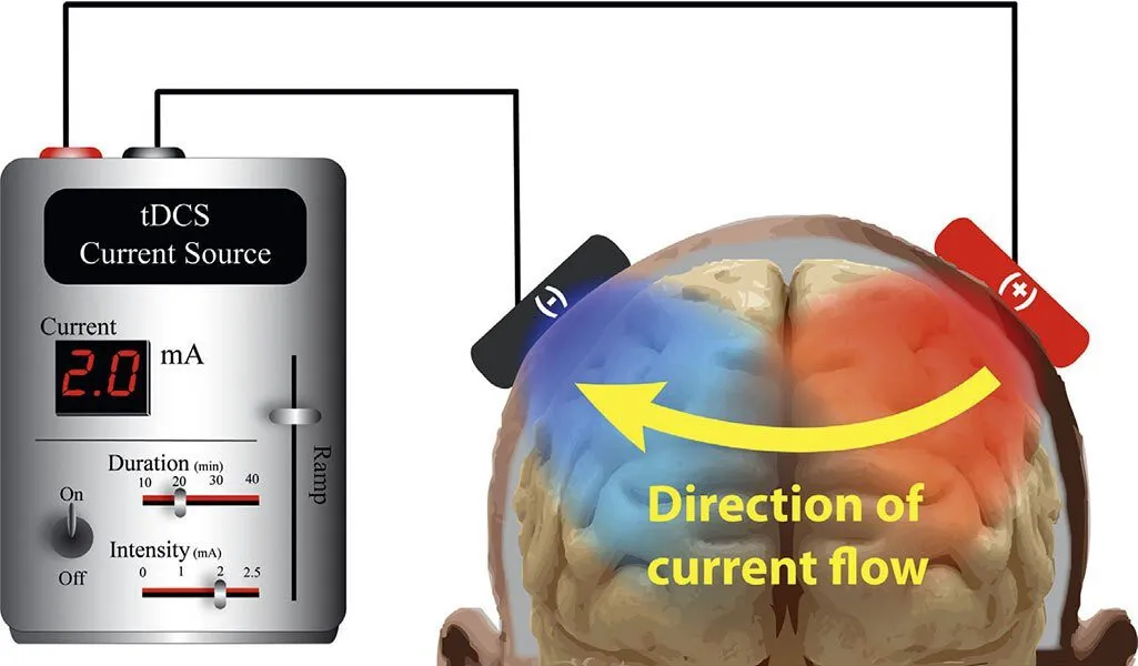 tDCS is typically administered for 20 minutes with a dosing intensity of 1 or 2 milli-amperes (mA). Image Credit: https://www.brainlatam.com/blog/novel-imaging-markers-of-current-flow-in-transcranial-direct-current-stimulation-tdcs-1533